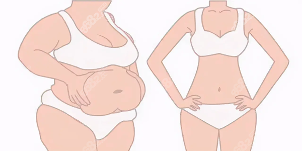 馬騰醫(yī)生做抽脂手術(shù)對比 馬騰醫(yī)生做抽脂手術(shù)對比