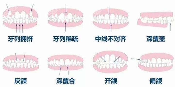 房山青少年及成人正畸的价格