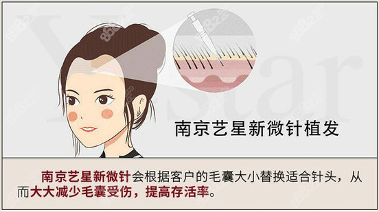 南京藝星植發(fā)口碑好