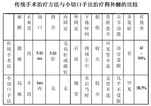 北京<!--<i data=20240705-sp></i>-->做拇外翻微创手术靠谱