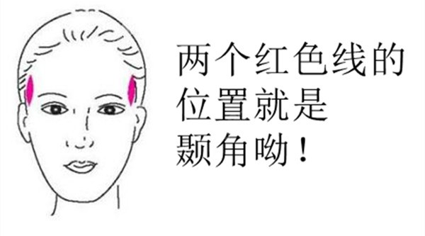 颞角种植是艺术种植