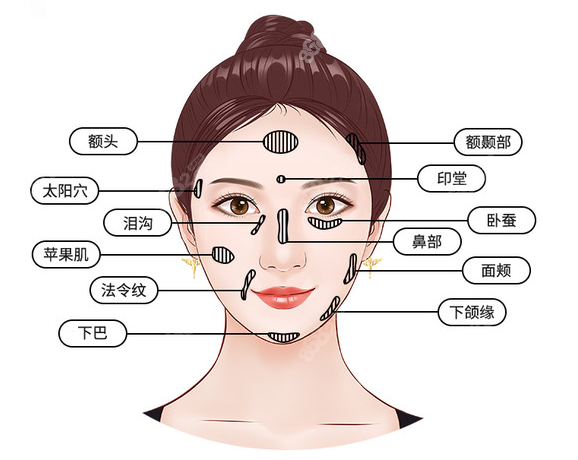 南宁做面部脂肪填充好的医院