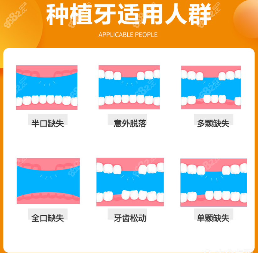 種植牙使用人群