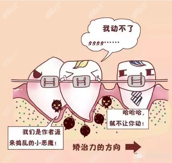 楚雄牙齿矫正大概要花费多少钱