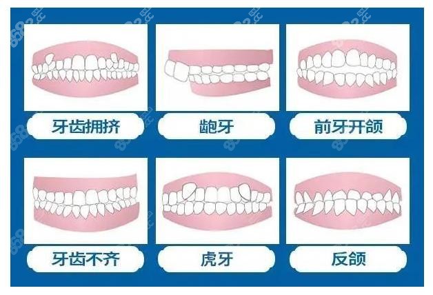 台州维多利亚口腔做牙齿矫正多少钱