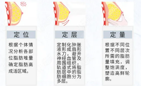 郑州华领徐刚强脂肪风险怎么样