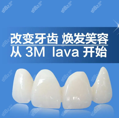 楚雄烤瓷牙价格表