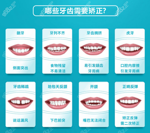 贵港矫正牙齿、戴牙套的价格