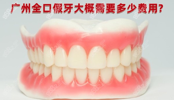 广州全口假牙大概需要多少费用?