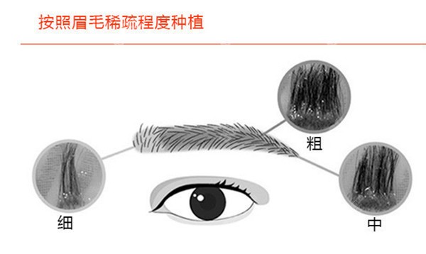 人工种植眉毛图