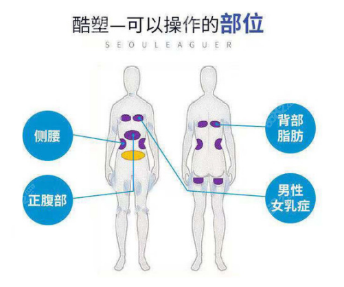 兰州时光做酷塑冷冻溶脂的部位