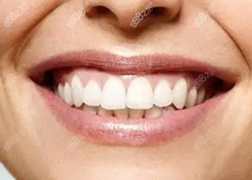 成都圣贝口腔整牙技术好