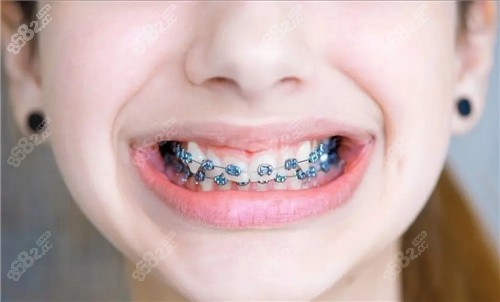 大連馬瀧齒科矯正技術(shù)好 大連馬瀧齒科矯正技術(shù)好