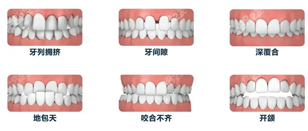 牙齿矫正可改变的情况