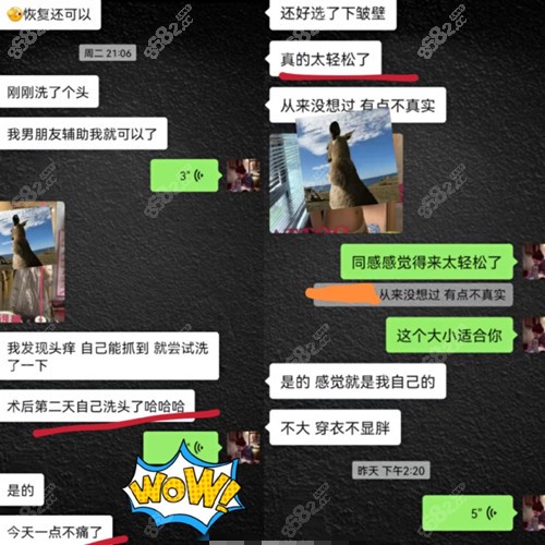 郝永生做的隆胸怎么样