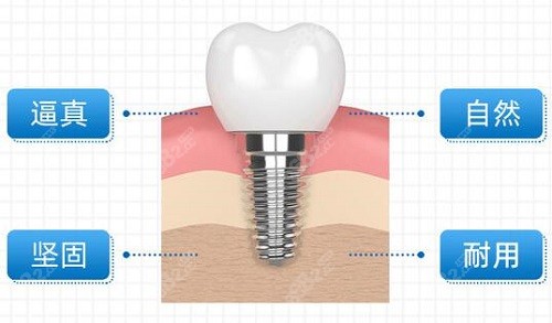 珠海口腔医院种植牙