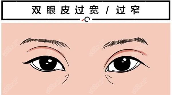 南京施尔美<!--<i data=20240705-sp></i>-->医生做修复眼睛怎么样