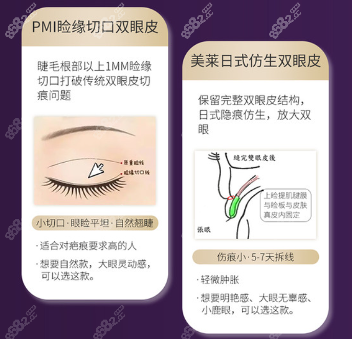 杭州美莱整形做双眼皮好吗