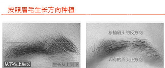 哈尔滨大麦微针植眉
