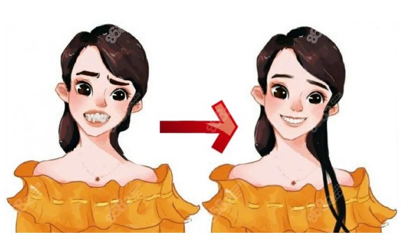 牙齿矫正前后结果对比图