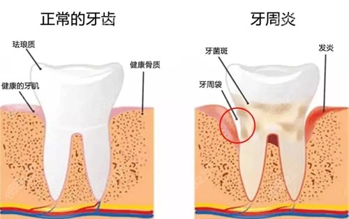 导致牙齿松动的原因