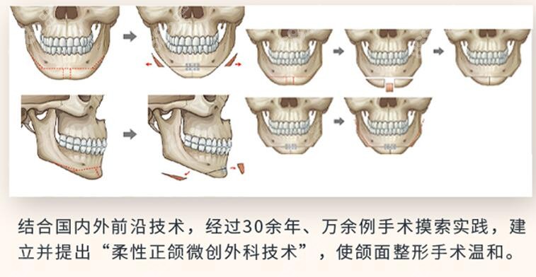 重庆宽仁<!--<i data=20240705-sp></i>-->医生做正颌技术