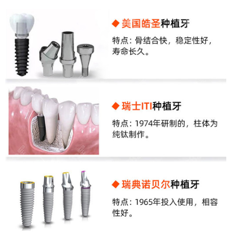 南宁岭南口腔做进口种植体的优势