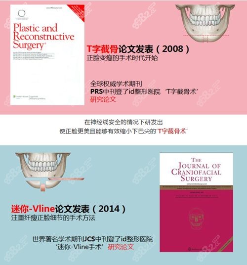 韩国id整形医院是韩国做轮廓三件套好的医院.jpg