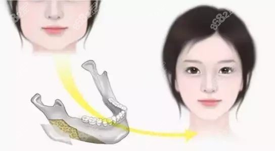 韩国专门做轮廓的医院医生名单分享.jpg