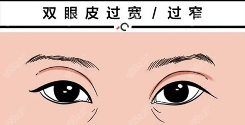 韩国高难度双眼皮修复哪里好？