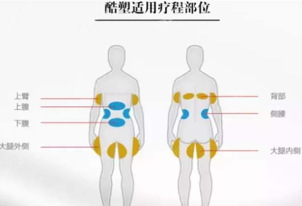 酷塑冷冻溶脂适合部位有哪些m.8682.cc