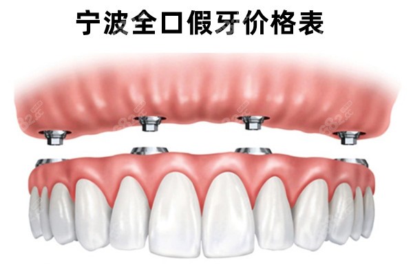 宁波全口假牙价格表