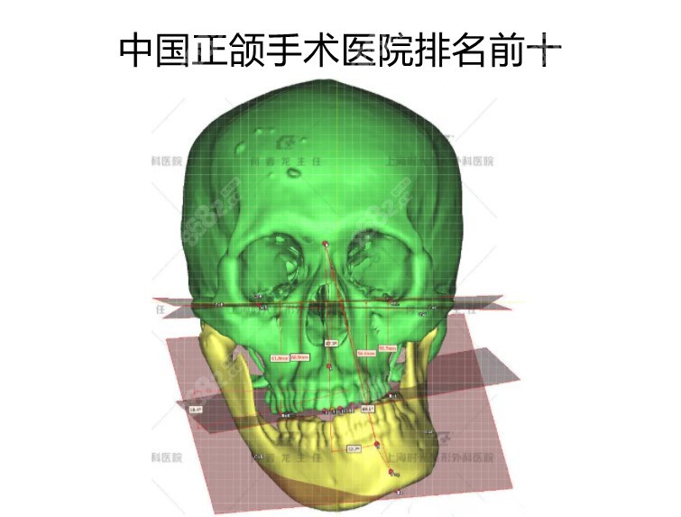 国内正颌手术排名前十医院