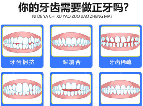 德阳牙科医院牙齿矫正