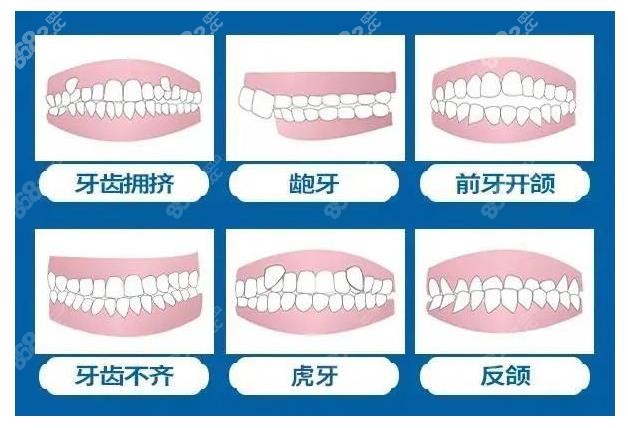 杭州下城区做牙齿矫正一般多少钱