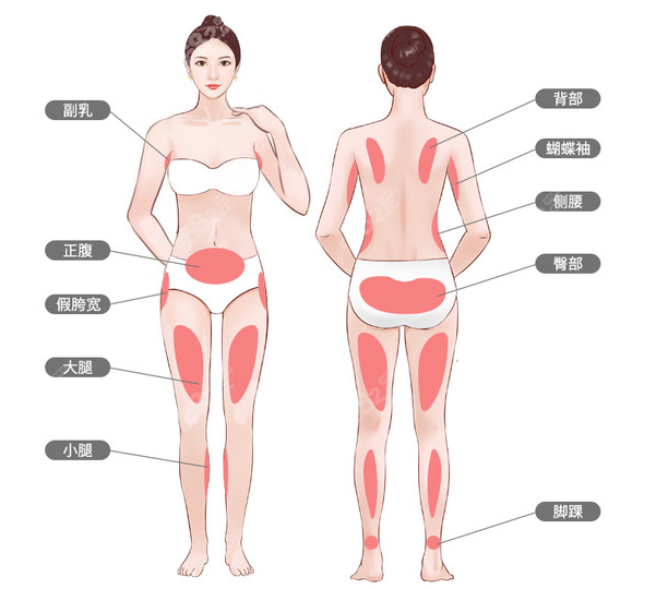 宁波全身吸脂价格表m.8682.cc