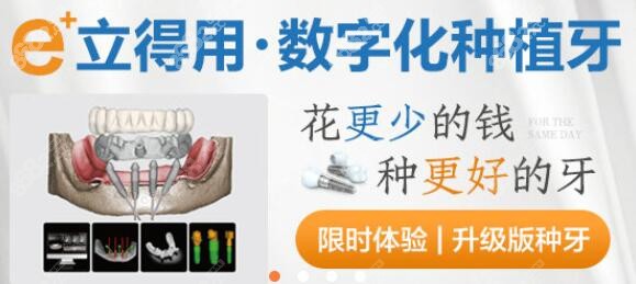 立得用数字化种植牙 立得用数字化种植牙