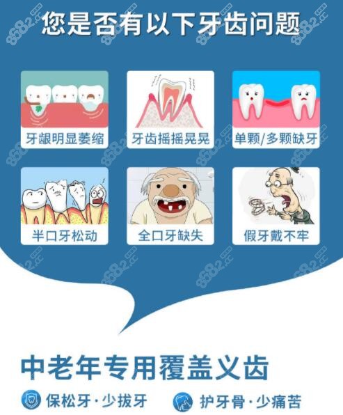 美冠塔中老年口腔医院中老年覆盖义齿