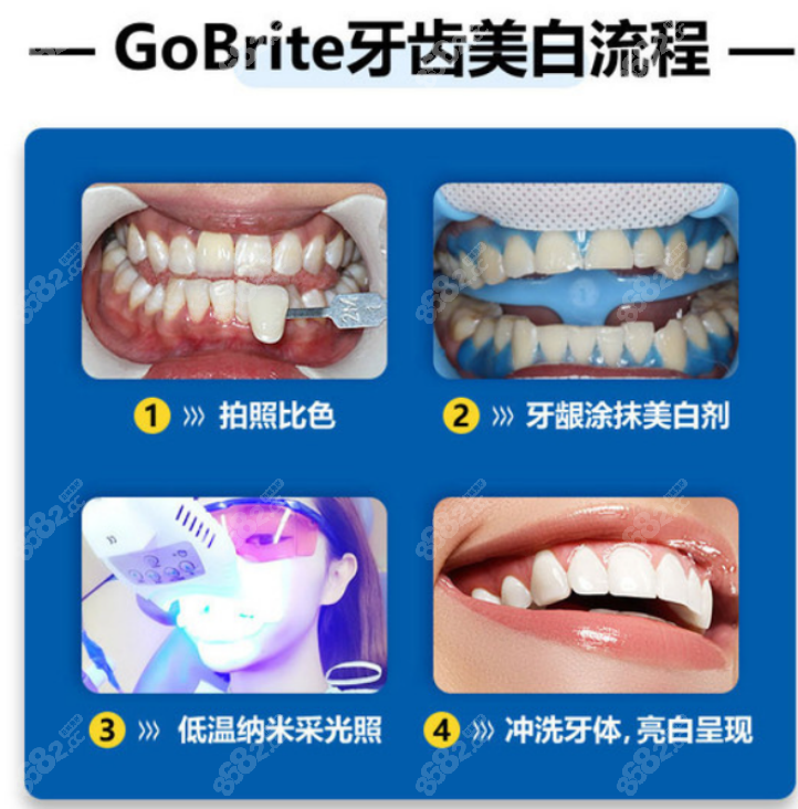 口腔医院牙齿美白价格