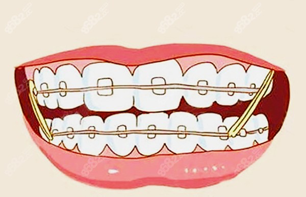传统金属矫正-4.jpg
