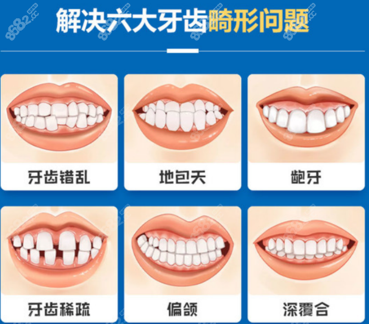 口腔医院牙齿矫正