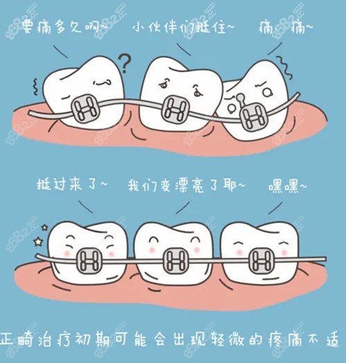 宜昌牙齿矫正哪家好？
