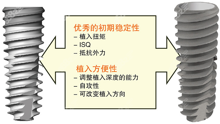 国产种植牙品牌一览表