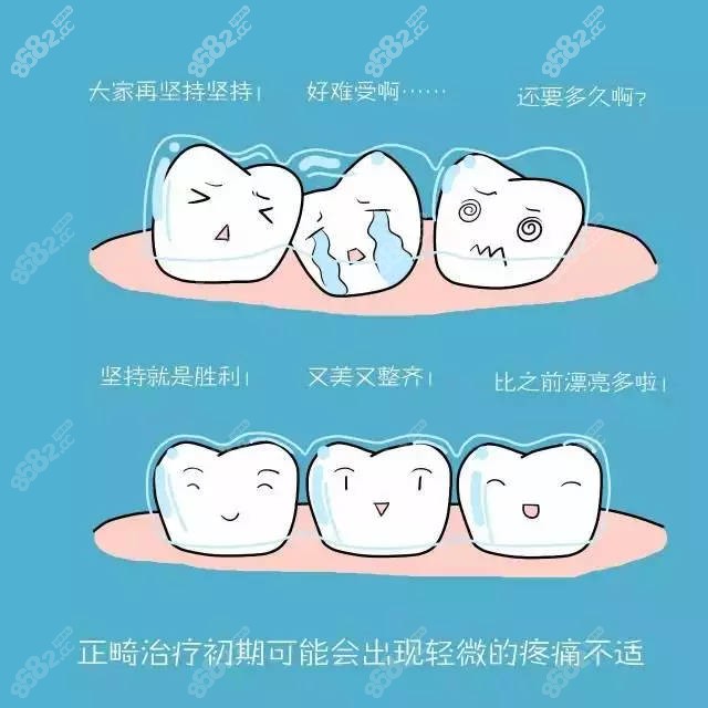 太原隐形牙齿矫正多少钱