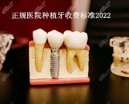 2022种植牙价格是多少