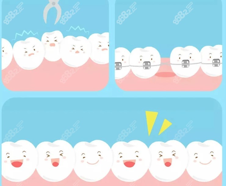 贵阳牙科医院牙齿矫正