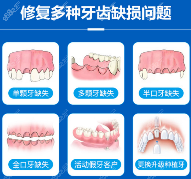 口腔医院种植牙