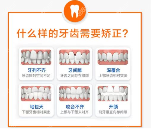 兰州皓亚口腔做牙齿矫正的类型