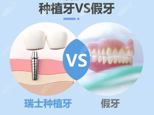 种植牙和假牙区别