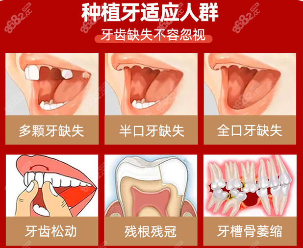 治疗单颗、多颗或半全口牙齿缺失的情况